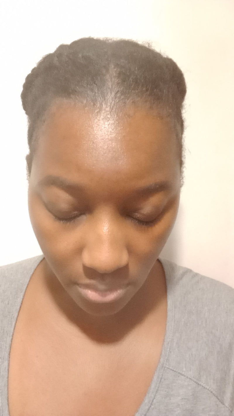 Après — D.D, 34 ans