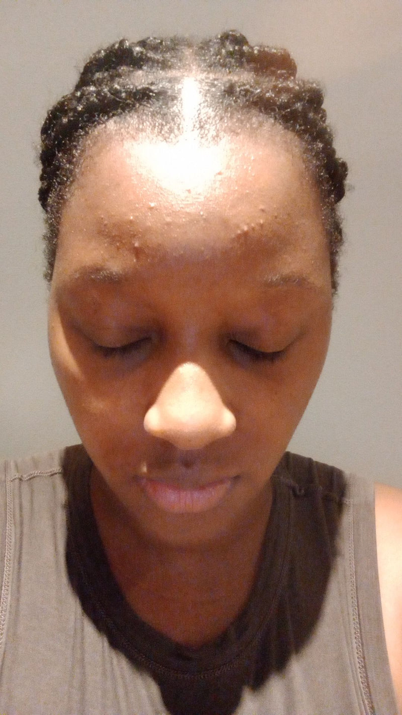 Avant — D.D, 34 ans