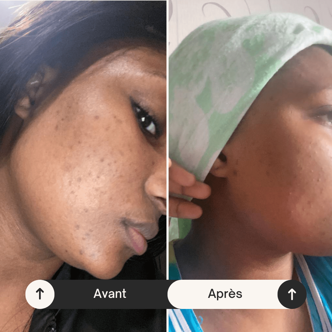 Nettoyant doux pour visage