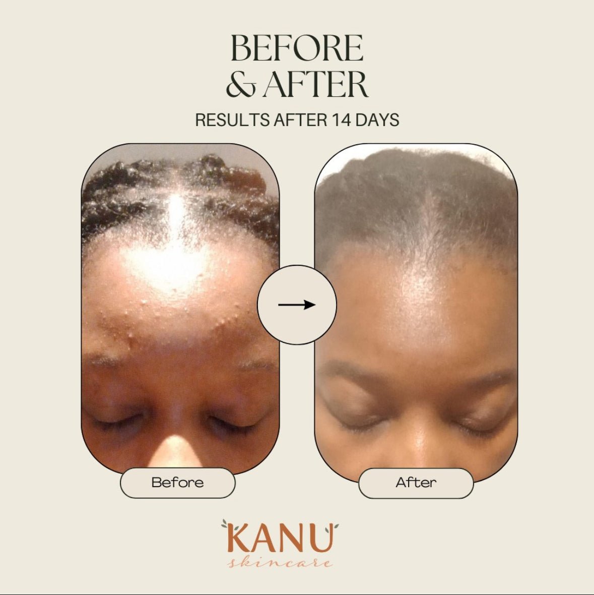 Sérum Éclaircissant