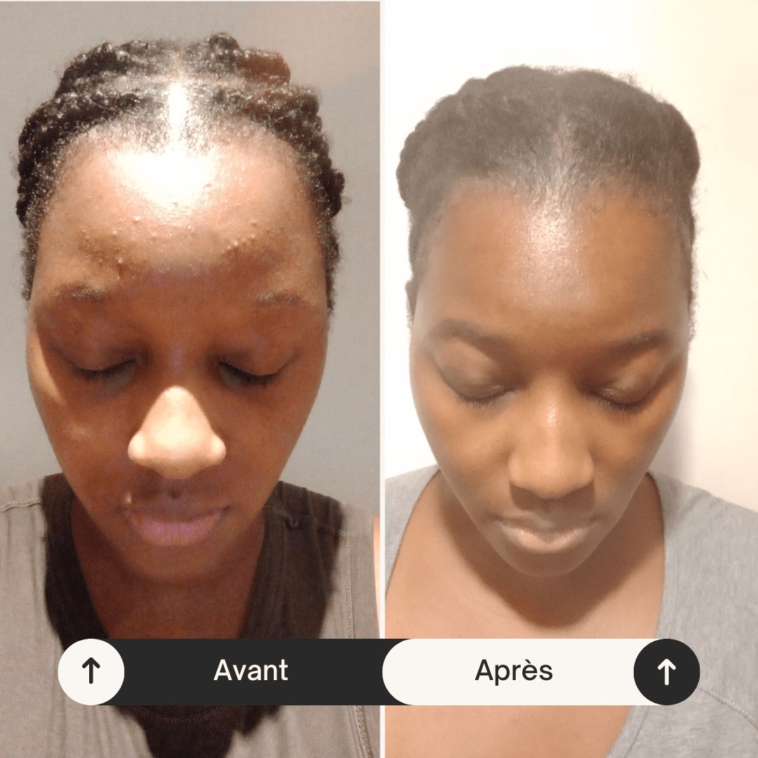 Sérum Éclaircissant